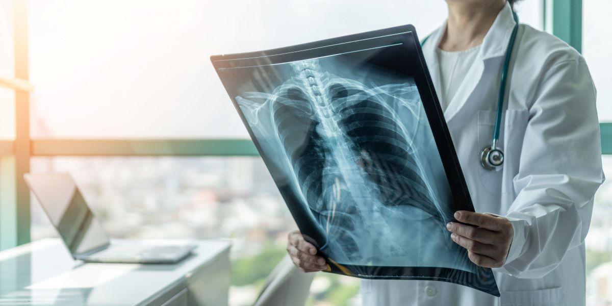 Obstructive Vs. Restrictive Lung Disease: Comparison Guide