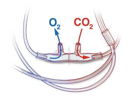 Sun Med Salter-Style Nasal Cannula