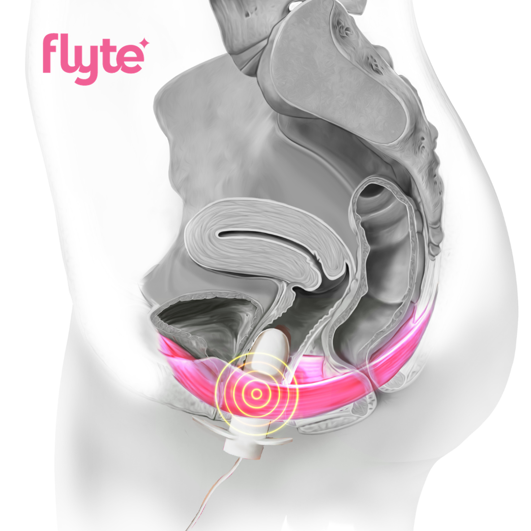 Flyte In-Home Pelvic Floor Therapy